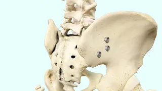 iFuse TORQ® Implant System - Animation