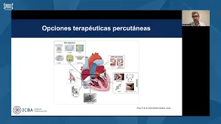 Webinar - Sistema Bicaval Tricvalve