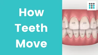 HOW TEETH MOVE WITH ALIGNERS & BRACES l Dr. Melissa Bailey Orthodontist