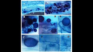 CLEARING AND STAINING OF MYCORRHIZAL ROOTS : PRACTICAL