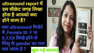 kya sach mein ultrasound report Mai female ya F, X,y,xx likhe hone se baby ka gender Jan sakte hai?