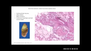 Basic Pathology & Molecular Diagnostics in NSCLC Dr  Nupur & Dr  Omshree