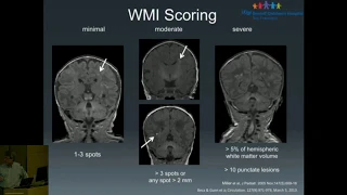 Neurodevelopment in CHD: Brain Imaging & Optimizing Outcomes