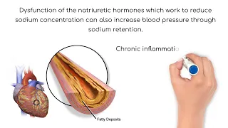 Pathophysiology: Hypertension