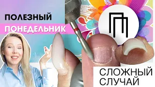 Сложные случаи😕 варианты решения