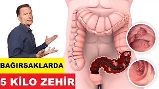 Kalın Bağırsağımızda ortalama 5 kilo zehirli Dışkı olabilir mi? - Dr. Berg Türkçe