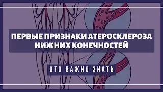 Основные симптомы атеросклероза нижних конечностей