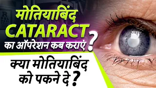 Cataract (मोतियाबिंद ) का ऑपरेशन कब कराएं | When is Cataract Surgery Necessary?