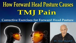 How Forward Head Posture Causes TMJ Pain (Exercises for Forward Head Posture) - Dr Mandell