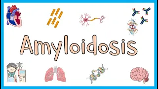 Amyloidosis - Definition, Classification Systems, Types of Amyloidosis, Pathology & Clinical Aspects