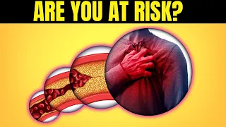 The Untold Secret To RISK FACTORS OF A HEART ATTACK IN WOMEN In Less Than Ten Minutes