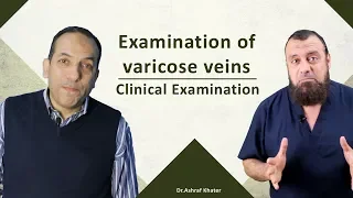 Examination of varicose veins- Clinical Examination