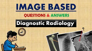 Image Based Questions & Answers || Diagnostic Radiology || Radiology MCQs || Radiography Q&A