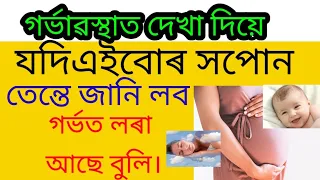 গৰ্ভাৱস্থাত এইবোৰ সপোন দেখিলে গৰ্ভত লৰা সন্তান হয়।#akhomiatgharuadihabychandrakala