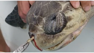 Plastic Straw Removed From A Sea Turtle's Nostril (Short Version)