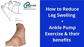 How to reduce leg swelling | ankle pump exercises | ankle swelling | lower leg swelling