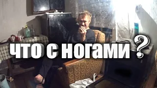 ПРИЕХАЛИ ПРОВЕДАТЬ // ЧТО С НОГОЙ ???