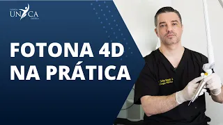 Veja Como é o Laser Fotona 4D na Prática