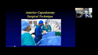 Lecture: Congenital Cataracts: Surgical Management and Pearls