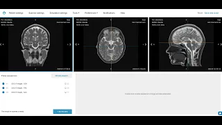 MRI Simulator Introduction – Corsmed