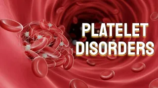Platelet Disorders and ITP (updated 2023) - CRASH! Medical Review Series