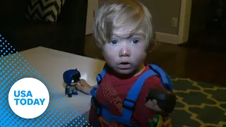 Toddler suffers from rare, vampire-like symptoms