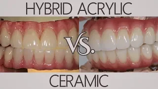 What's the difference between acrylic and ceramic? | Patients Ask