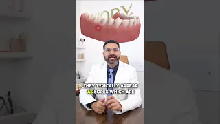 tired of Mouth ulcers. watch this #toothdoctor #dentalworld #dentalcare #business #oralhealth #