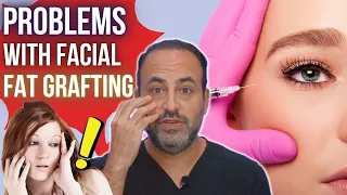 Problems with Facial Fat Grafting | Dr. Ben Talei | Beverly Hills Plastic Surgeon