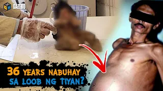 Hindi Akalain ng mga Doktor na Ito ang Makikita Nila sa Loob ng Tiyan ng Lalaking Ito!