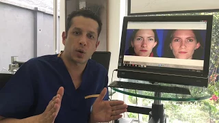 Blefaroplastia | Dr. Ivan Santos - Cirugía plástica en Colombia |