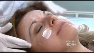 PHILADELPHIA (CBS) - Smooth, Pretty, Young Looking Skin Treatment Available - Dermapen
