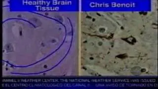 Chris Benoits Dad uncovers possible motive for Chris Benoit