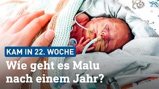 Extrem-Frühchen Malu (22. SSW): So geht es ihm nach einem Jahr | hessenschau