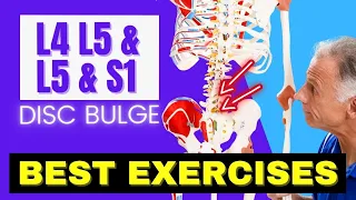 L4 L5 & L5 S1 Disc Bulge, Best Exercises Rehab For Relief