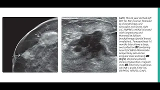 BREAST DIAGNOSTIC IMAGING SERIES(4)