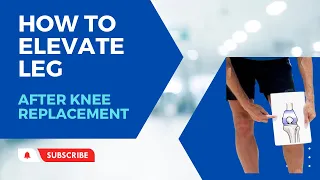 How To Elevate Your Leg After Total Knee Replacement