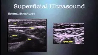 Superfical and Soft Tissue Ultrasound