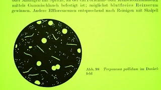 Dunkelfeldmikroskopie in der wissenschaftlichen Literatur