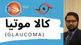 Glaucoma Symptoms Treatment Laser Surgery in Urdu / Hindi I Aankhoon men Kala Motia / Kala Pani