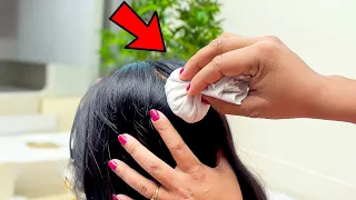 Amazing Hacks to Solve Hair & Scalp Issues Forever| Beauty hacks @ArtkalaAngan