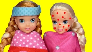 Toddler is SICK ! Elsa & Anna - CHICKENPOX - The other PRETENDS ? Who's really sick ? Doctor Barbie