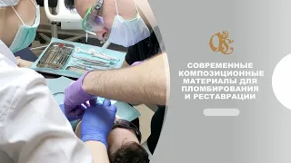 Современные композиционные материалы для пломбирования и реставрации зубов в Петербурге