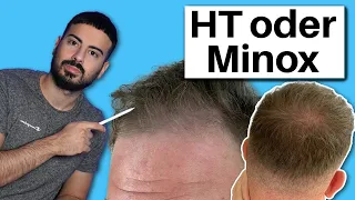 Haartransplantation oder Minoxidil & Finasterid | Was soll er machen?