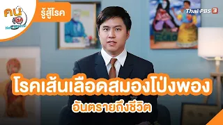 โรคเส้นเลือดสมองโป่งพอง | รู้สู้โรค | คนสู้โรค