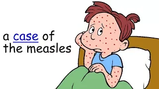 case-instance of a disease,a case of measles ASL