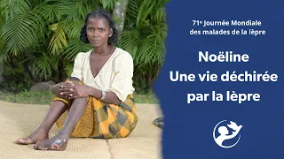 Noëline : Une vie déchirée par la lèpre