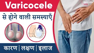 Varicocele से होने वाली समस्याएँ और इलाज | ✅#Varicocele Symptoms, Causes And Treatment in Hindi