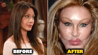 The Bold and the Beautiful Actors who have done Plastic Surgery