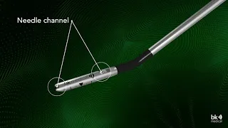 Advanced Laparoscopic Transducer Video